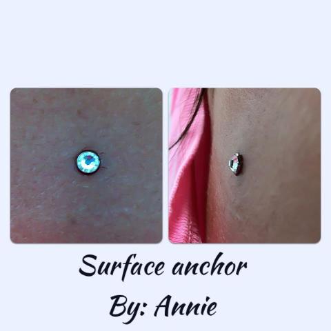 Annie_Surface_Anchor.jpg